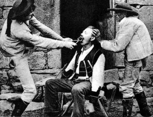 Teeth, blood, and Old West dentistry